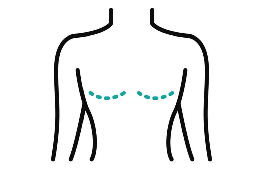 Buyer Beware My Mastectomy Flat Closure Nightmare
