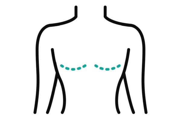 Buyer Beware My Mastectomy Flat Closure Nightmare