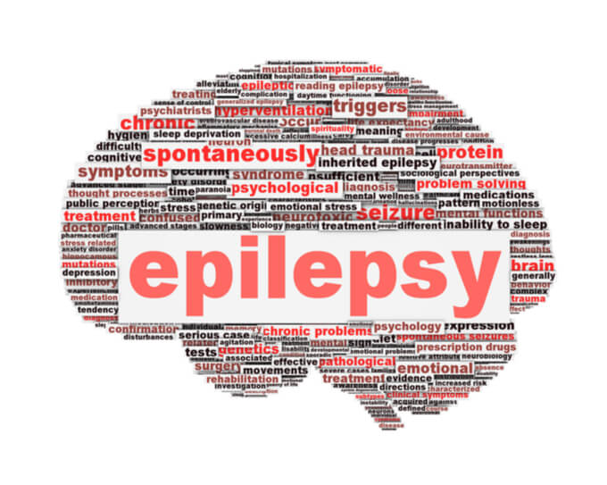 Top 5 Alternative Treatments for Epilepsy
